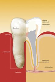 Gefüllte Zahnwurzel nach der Wurzelbehandlung
